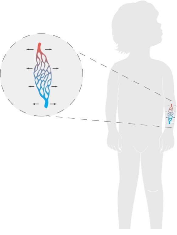 Capillary Leak Diagram