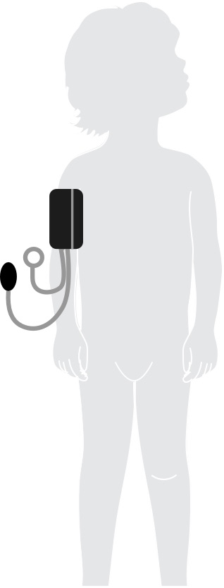 Low Blood Pressure Diagram