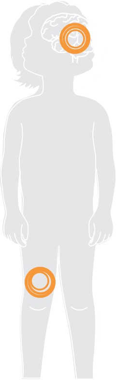 Pain Diagram